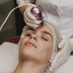 Radio frequency microneedling treatments