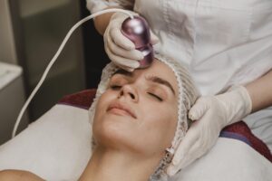 Radio frequency microneedling treatments