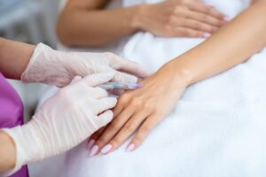 Fillers for Hands in Dubai