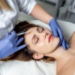 Microneedling treatment in dubai