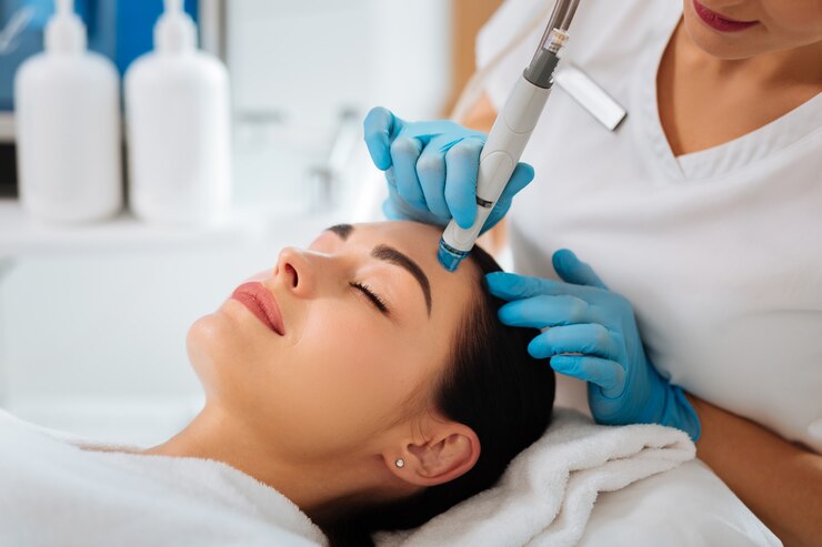 Microneedling treatment