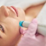 Best Ultraformer MPT Treatment