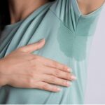 hyperhidrosis treatment Dubai