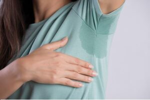 hyperhidrosis treatment Dubai