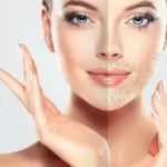 hirsutism-featured-img