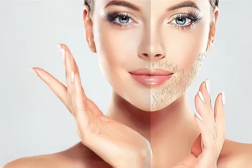 hirsutism-featured-img