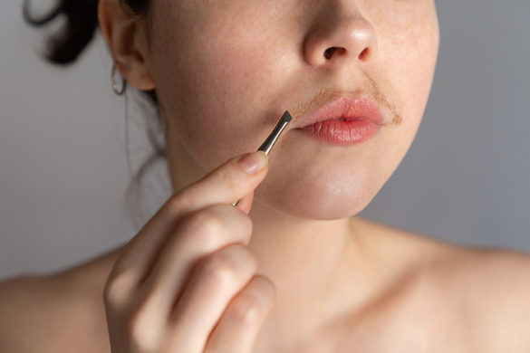 why-you-should-not-ignore-hirsutism