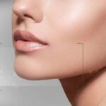 jawline-contouring-in-dubai
