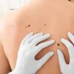 mole-mapping-in-dubai