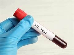 STD Screening in Dubai