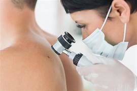 Skin Cancer Screening