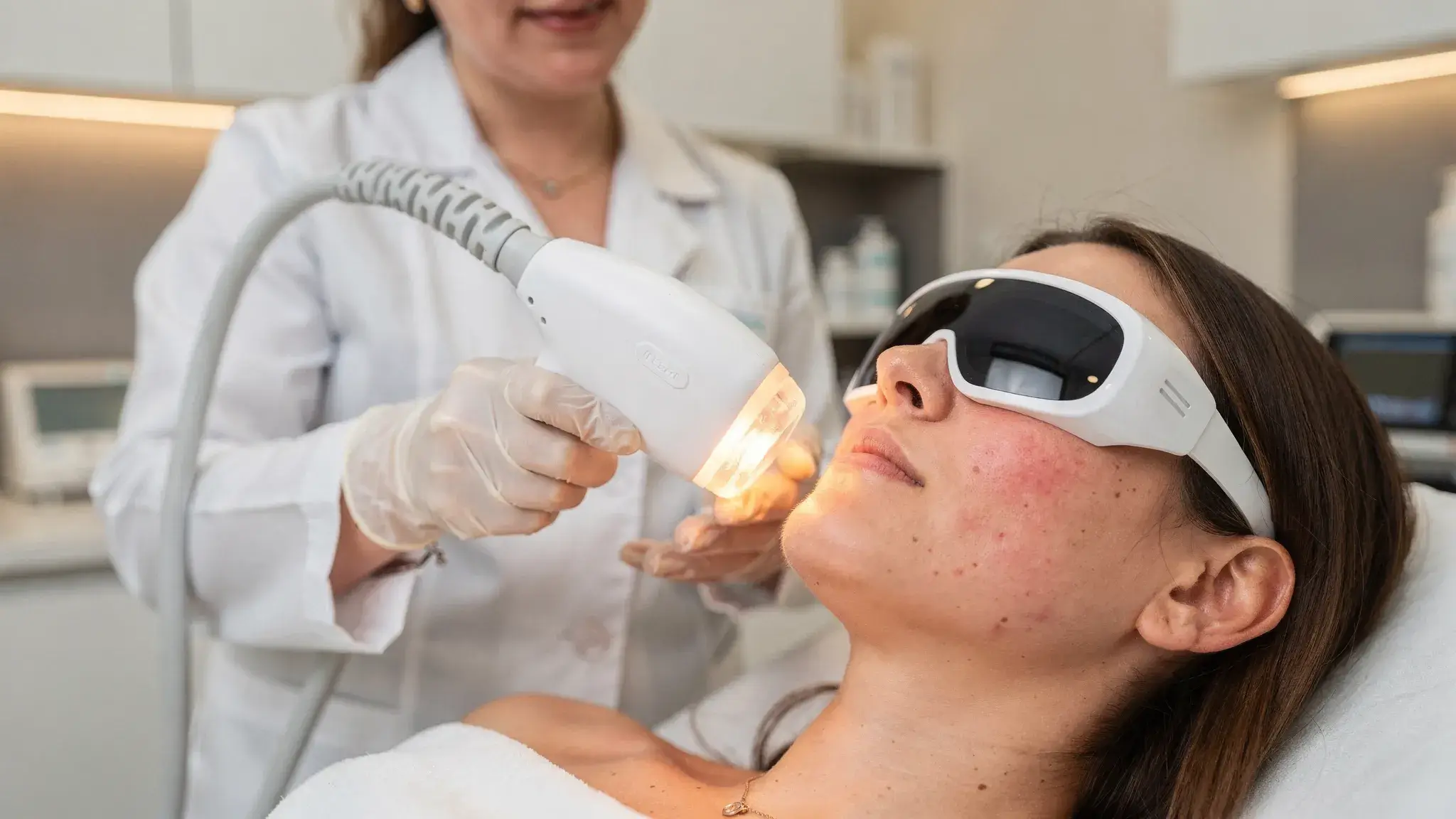 A dermatologist performing IPL on a patient’s cheek to target diffuse facial redness, eye shields in place, handheld device emitting a soft pulse of light, clinical room with gentle lighting, focus on safety and precision.