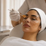 Melasma and Hyperpigmentation Treatment in Dubai