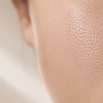 Best Treatment for Pores on Face