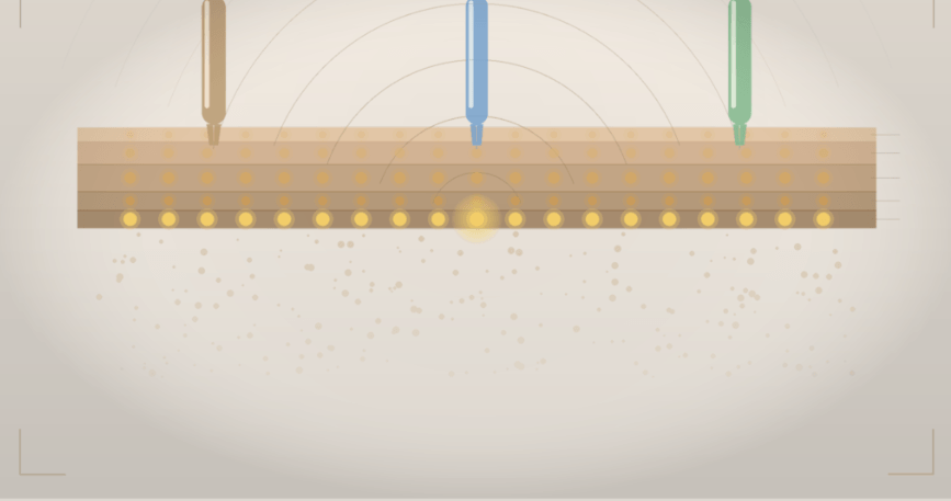 Three HIFU device handpieces targeting skin layers — Ultherapy, HIFU and Ultraformer MPT comparison illustration