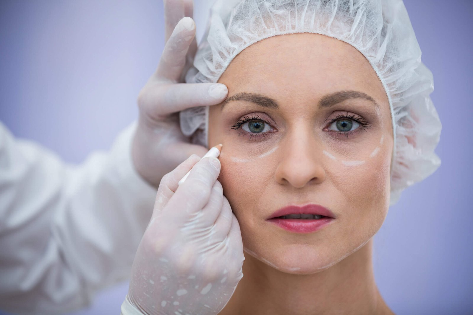 Dark Circles and Eye Bag Treatment in Dubai