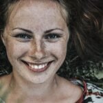 freckles on face