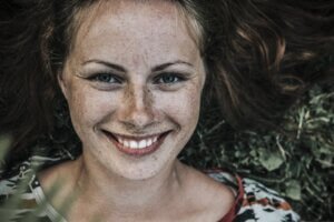 freckles on face